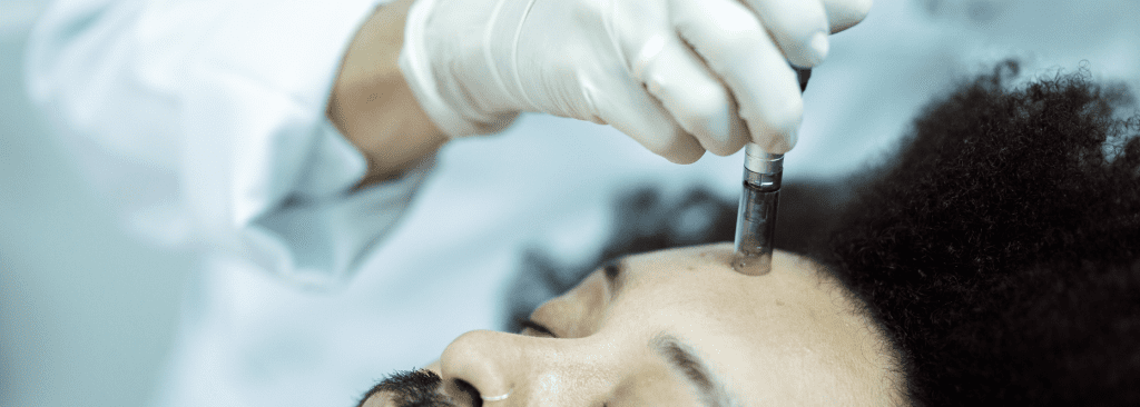 Level 4 VTCT Certificate in Skin Needling