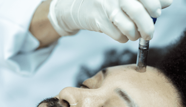 Level 4 VTCT Certificate in Skin Needling