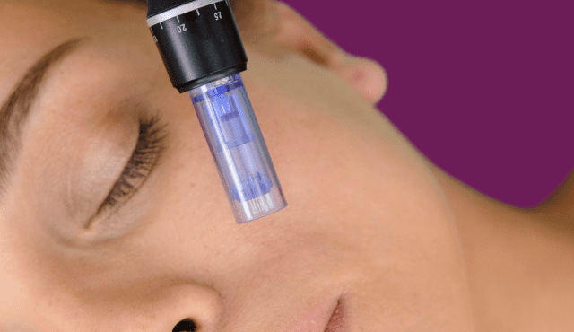 microneedling course